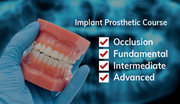 Implant_Prosthetic_Course Implant_Prosthetic_Course