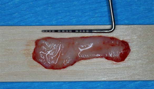 GDIA-Live-Surgery-Continuum_th GDIA-Live-Surgery-Continuum_th