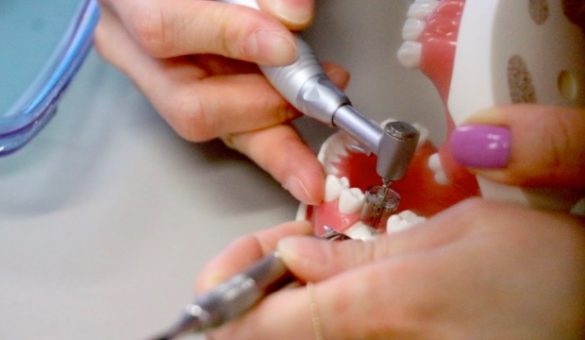 Top Down Implant Course in Las Vegas_th Top Down Implant Course in Las Vegas_th