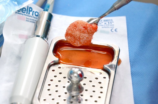 implifying_Grafting_Procedures_th implifying_Grafting_Procedures_th